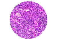 Microscopic image of human endometrium showing glandular structures and stromal cells, stained for histological examination in reproductive pathology.&nbsp;