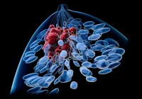 3D medical illustration of breast anatomy with highlighted tumour, representing breast cancer development, early detection and oncology research.&nbsp;