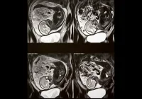 MRI scan series showing a developing fetus in the womb, used for prenatal imaging, foetal health assessment and monitoring pregnancy progression.&nbsp;