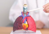 Doctor using anatomical model of human lungs and trachea to explain respiratory system.