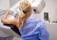 Woman undergoing mammogram screening symbolising breast cancer detection and women&rsquo;s preventive healthcare&nbsp;