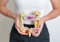 Woman holding colon model to illustrate digestive health and colorectal disease awareness&nbsp;