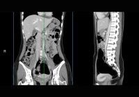 Abdominal and pelvic CT scan showing detailed cross-sectional anatomy for diagnostic imaging&nbsp;