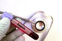 Metabolic Shifts Precede Sepsis Organ Dysfunction