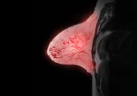 Breast MRI scan showing detailed tissue structure for cancer detection and diagnosis&nbsp;
