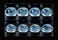 Series of MRI slices of the abdomen used for clinical evaluation and treatment planning&nbsp;
