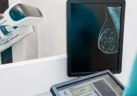 A mammography scan is displayed on a monitor, showing breast tissue imaging.&nbsp;