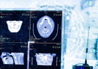 CT scans on a hospital workstation with AI overlay.&nbsp;