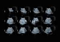 Multipanel&nbsp;abdominal ultrasound scans of the liver in different views.&nbsp;