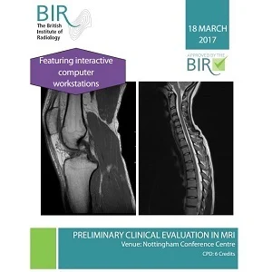 Preliminary Clinical Evaluation in MRI 2017