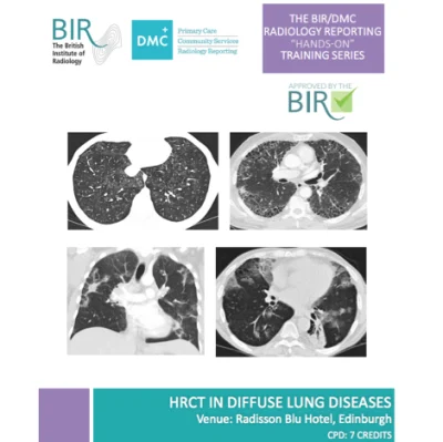 The BIR/DMC Radiology Reporting &ldquo;Hands-On&rdquo; training series: HRCT in diffuse lung