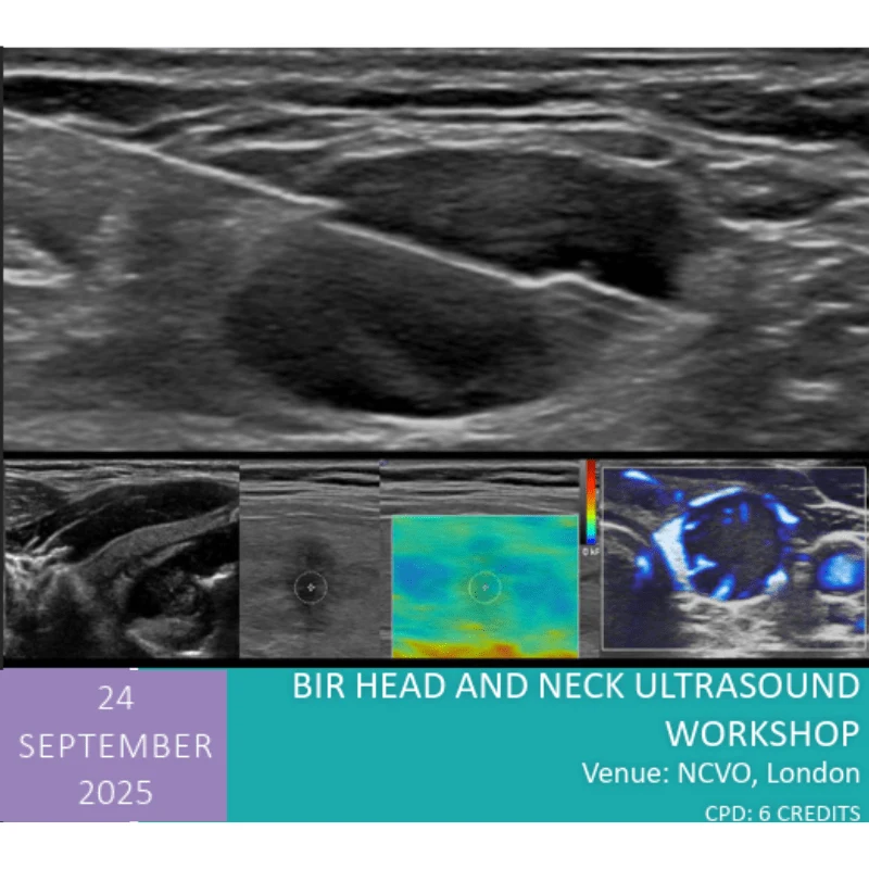 BIR Head and Neck Ultrasound Workshop 2025 BIR Head and Neck Ultrasound Workshop 2025