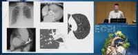 How to Improve Chest CT Reports