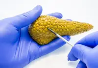 Doctor explaining pancreatic anatomy using medical model for patient education or diagnosis&nbsp;