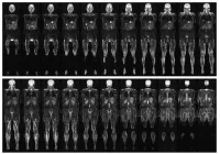 Whole-body MRI scan showing coronal slices for comprehensive diagnostic imaging and oncology staging.&nbsp;