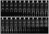 Whole-body MRI scan showing detailed coronal sections for comprehensive medical diagnosis&nbsp;