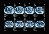 Series of MRI slices of the abdomen used for clinical evaluation and treatment planning&nbsp;