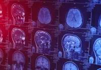 MRI brain scans on digital screen with medical data analysis in modern radiology.&nbsp;