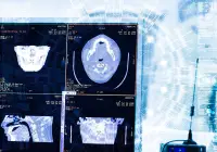 CT scans on a hospital workstation with AI overlay.&nbsp;