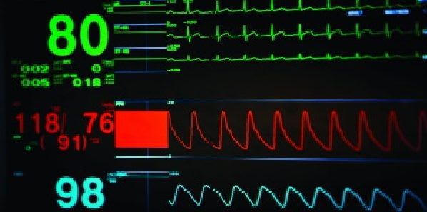 Big Data Tackles Alarm Fatigue Big Data Tackles Alarm Fatigue