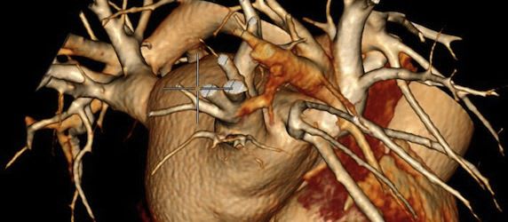 Agfa to highlight IMPAX Cardiovascular IT solutions at EuroPCR Agfa to highlight IMPAX Cardiovascular IT solutions at EuroPCR