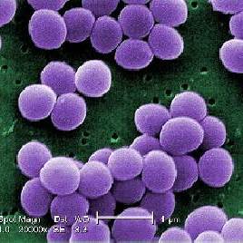 A strain of Staph bacteria A strain of Staph bacteria