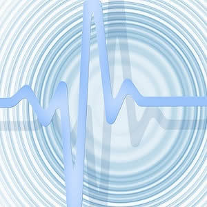 #ESC17: Implanted Cardiac Monitors Detect Undiagnosed Atrial Fibrillation #ESC17: Implanted Cardiac Monitors Detect Undiagnosed Atrial Fibrillation
