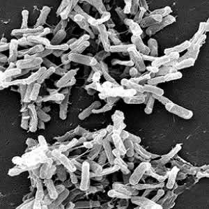 Sleeping with the enemy: C.difficile infection in ICU Sleeping with the enemy: C.difficile infection in ICU