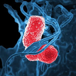 Sepsis-3 can help predict community-acquired pneumonia mortality Sepsis-3 can help predict community-acquired pneumonia mortality