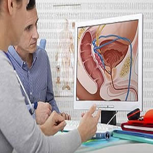 PSMA PET/CT for detecting prostate cancer PSMA PET/CT for detecting prostate cancer