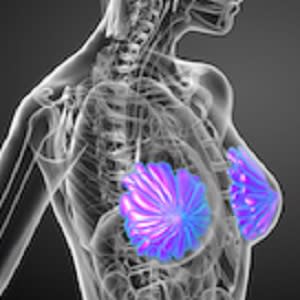 Breast cancer screening: performance of supplemental ultrasonography Breast cancer screening: performance of supplemental ultrasonography