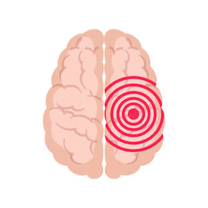 #SIR2019: Innovative training helps IR's save stroke patient lives #SIR2019: Innovative training helps IR's save stroke patient lives