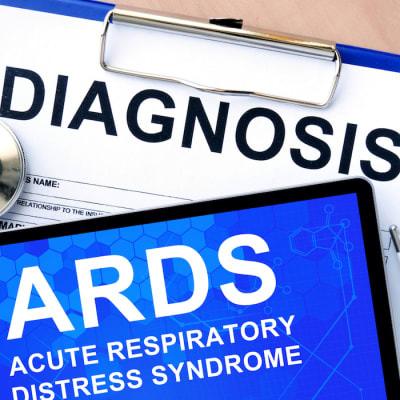 Lung Recruitment in Patients with Severe ARDS Lung Recruitment in Patients with Severe ARDS