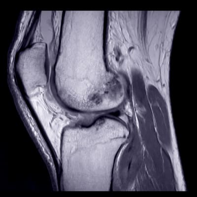 Focus on Sports Imaging for International Day of Radiology Focus on Sports Imaging for International Day of Radiology