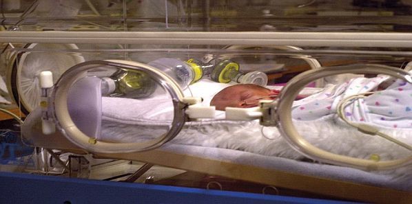 2-Minute Training For Neonatal Mask Ventilation 2-Minute Training For Neonatal Mask Ventilation