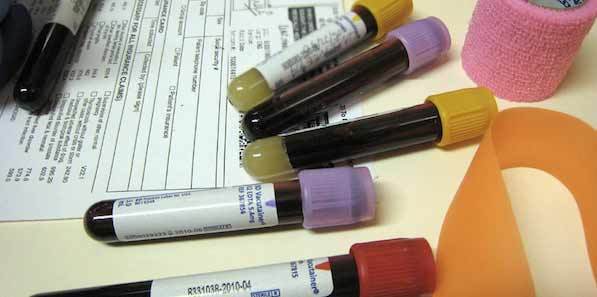 Blood Tests: From $10 to $10,169 Blood Tests: From $10 to $10,169