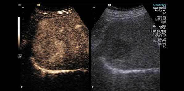 First UK Installs of Siemens ‘Helx Evolution’ Ultrasound First UK Installs of Siemens ‘Helx Evolution’ Ultrasound