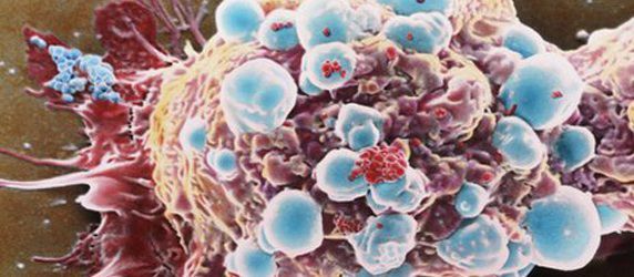Spread of Cancer Potentially Halted by ‘Sticky Balls’ Spread of Cancer Potentially Halted by ‘Sticky Balls’