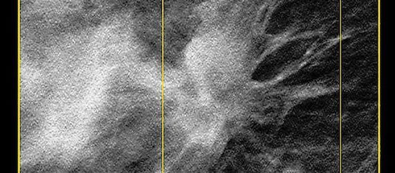 RSNA 2013: Hologic to Showcase its 3D Imaging Portfolio RSNA 2013: Hologic to Showcase its 3D Imaging Portfolio