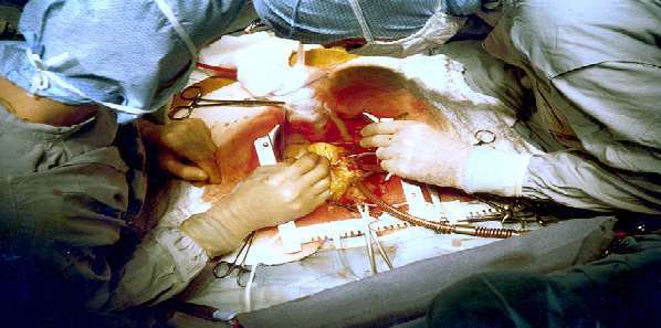 Paediatric and Congenital Heart Surgery Outcomes Now Online Paediatric and Congenital Heart Surgery Outcomes Now Online