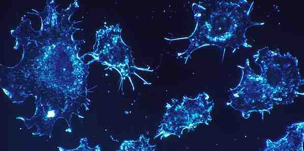 New MRI Technique Improves Prostate Cancer Detection New MRI Technique Improves Prostate Cancer Detection