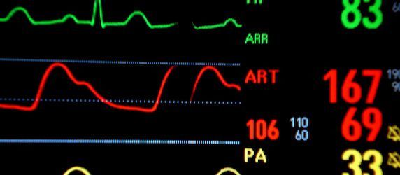 Heart Attack Survival Rates Set to Improve With Pocket Manual for First 