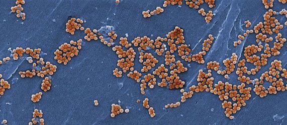Chemists Uncover New Class of Antibiotics Chemists Uncover New Class of Antibiotics