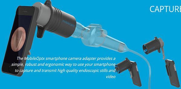 Smartphone Camera Tool Captures Endoscopic Images Smartphone Camera Tool Captures Endoscopic Images