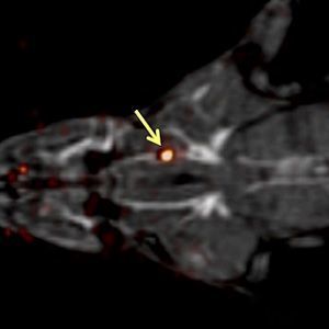 scan showing a blood clot in a rat (cropped image) scan showing a blood clot in a rat (cropped image)