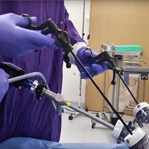 a new imaging paradigm for gallbladder removal a new imaging paradigm for gallbladder removal