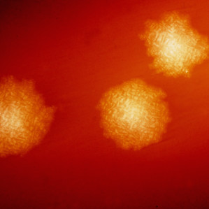 European Congress of Clinical Microbiology and Infectious Diseases 2015: C. Diff report European Congress of Clinical Microbiology and Infectious Diseases 2015: C. Diff report