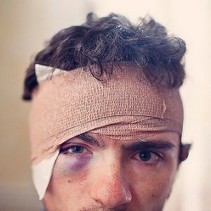 head injury head injury