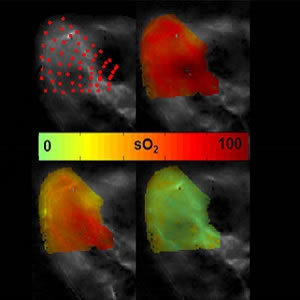 New Imaging Method for Showing Oxygen In Tissue New Imaging Method for Showing Oxygen In Tissue