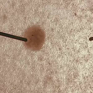 Functional Heart Pacemaker Cells Developed Functional Heart Pacemaker Cells Developed